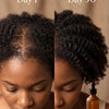 Hair growth progress - Day 1 vs Day 90 using Atorisé Protocol
