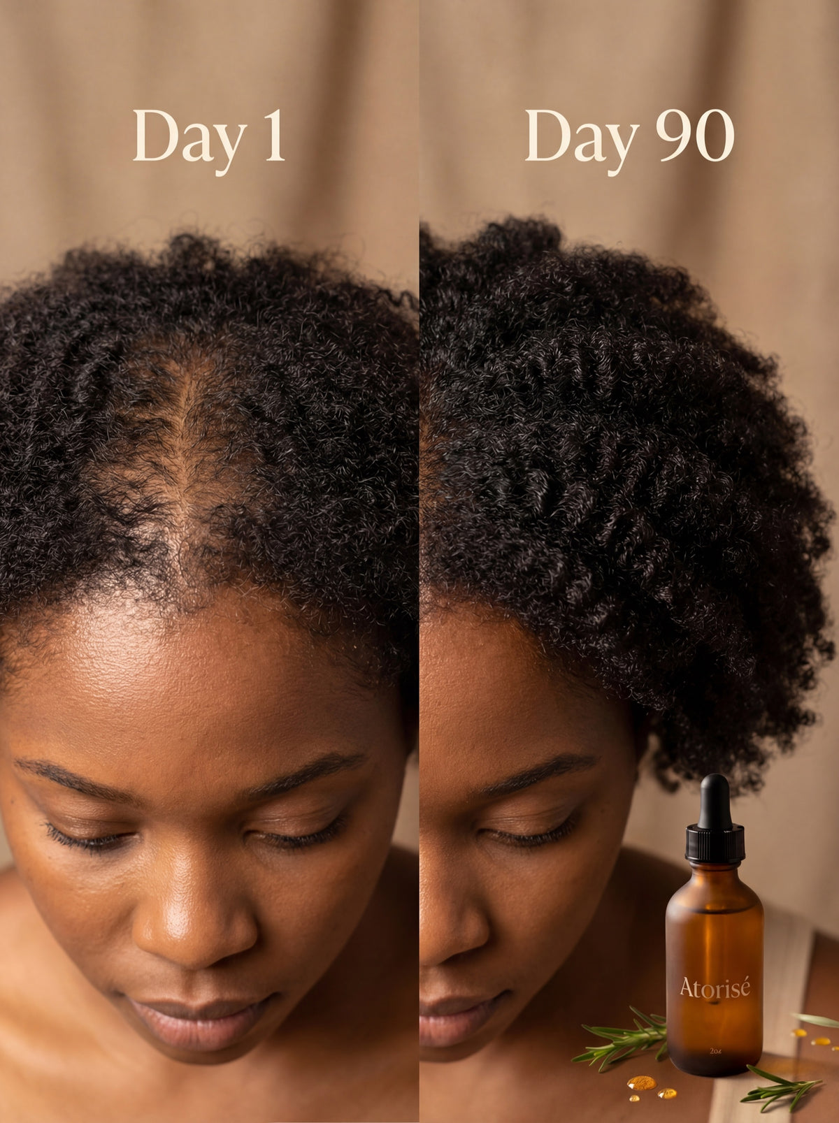 Hair growth progress — Day 1 vs Day 90