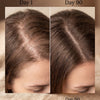 Hair density improvement - Day 1 vs Day 90 using Atorisé Protocol