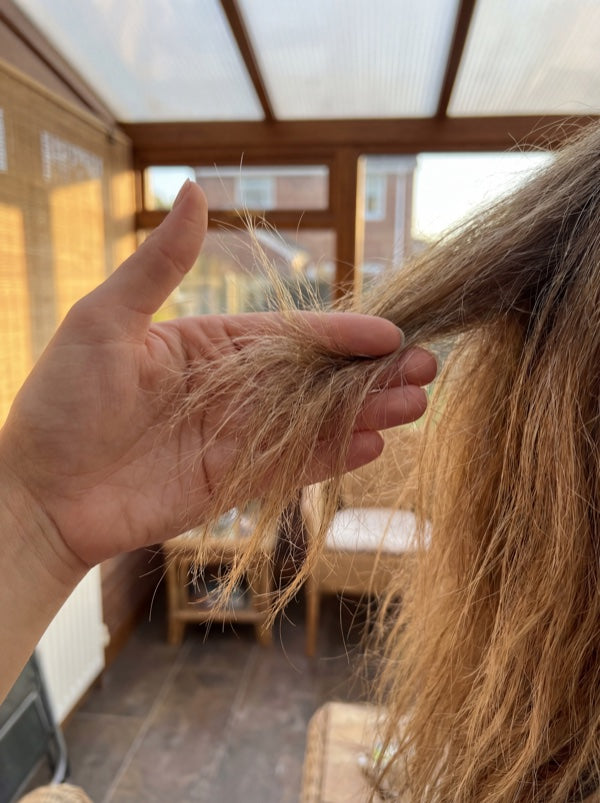 Woman showing thinning edges and hairline